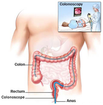 Colon Cleansing Testimonial