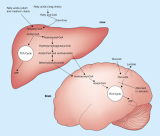 Ketogenic Diet